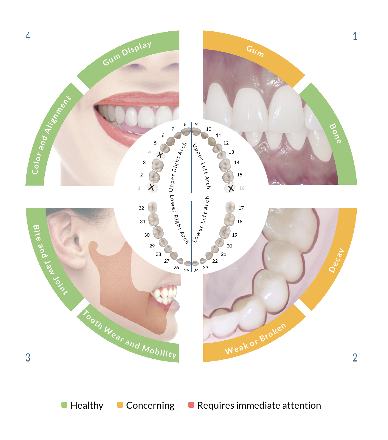 The True Wellness Score wheel: four dimensions of oral health color-coded green, yellow, and red